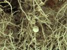 Ramalina nematodes (licheen)